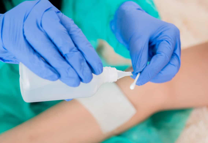 Profesional con guantes realiza una curación de herida en la pierna