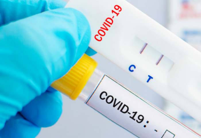Test rápido de COVID-19 y tubo de muestra en mano enguantada