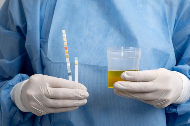 Profesional de laboratorio con guantes sostiene una muestra de orina y tiras reactivas