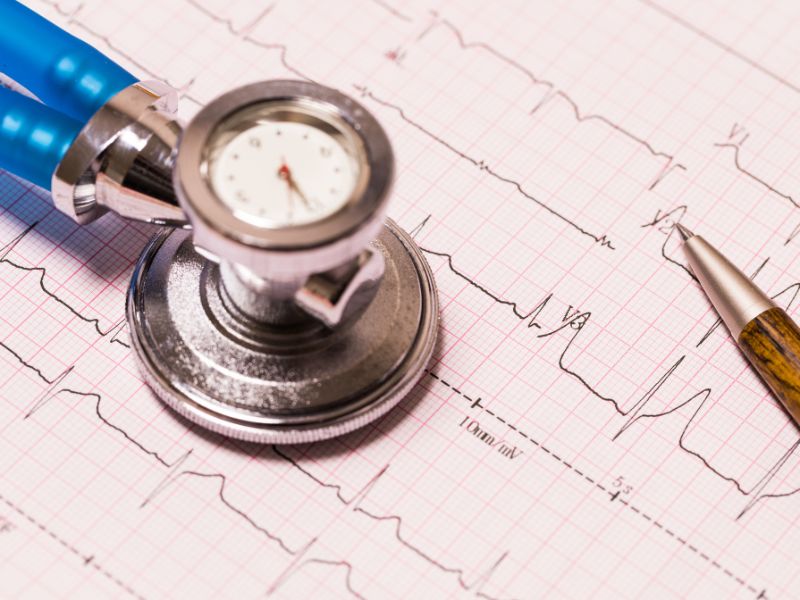 electrocardiograma a domicilio